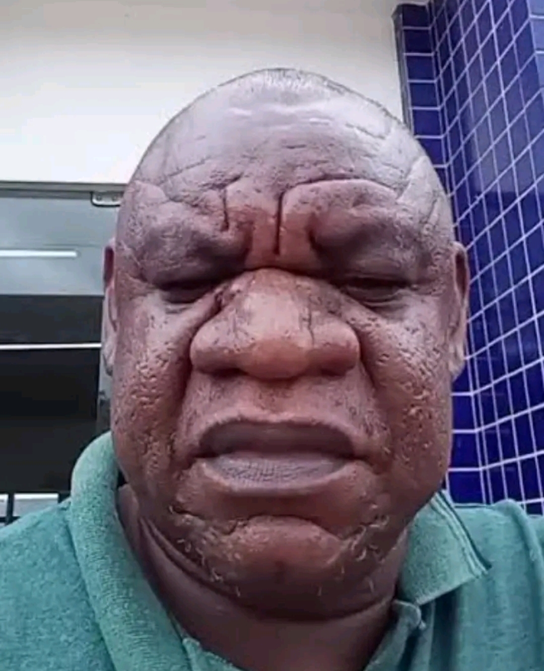 1000005740