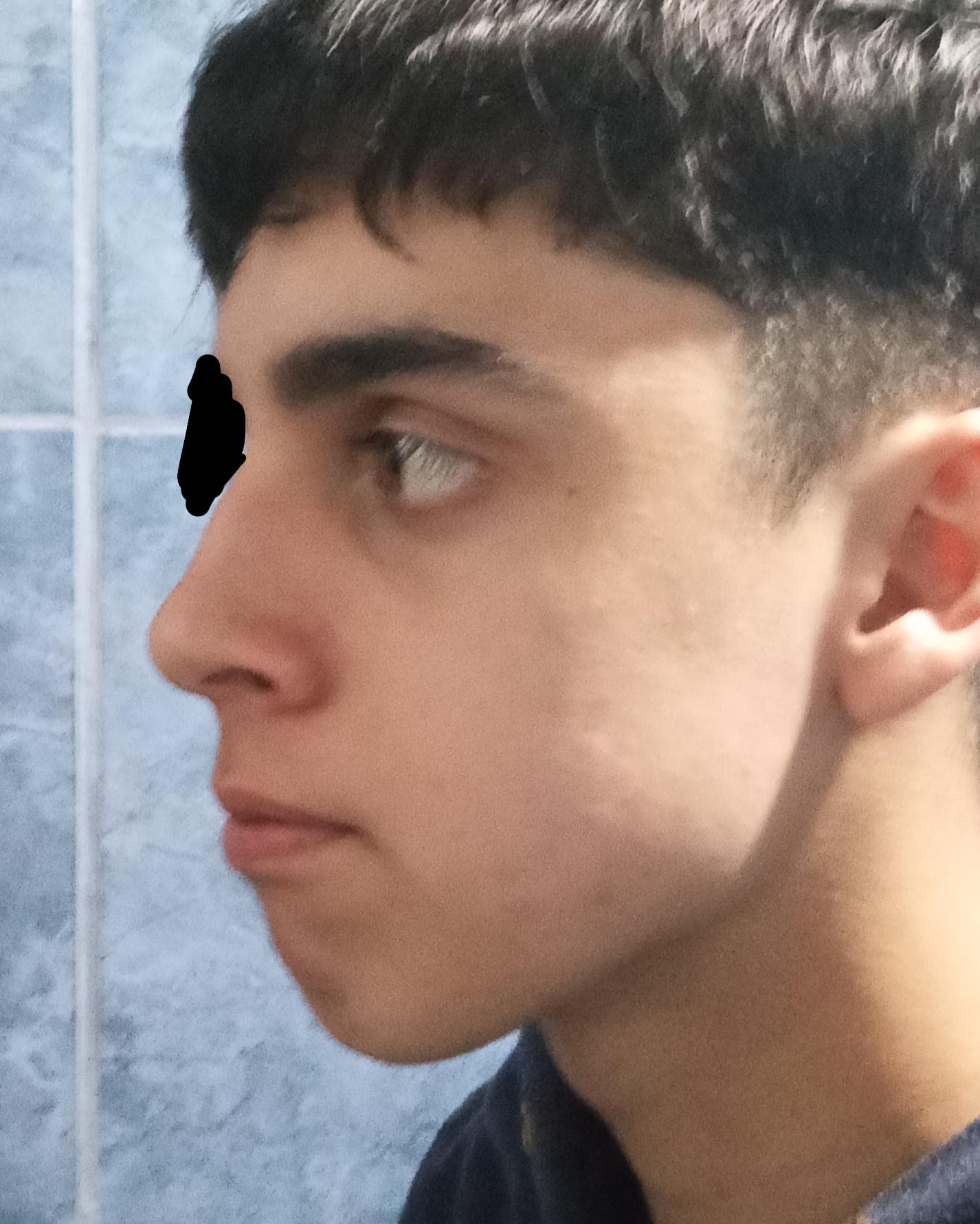 1000043346