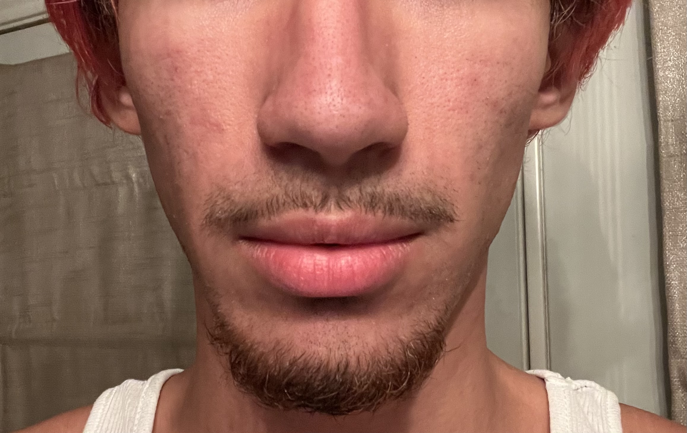 IMG 2609