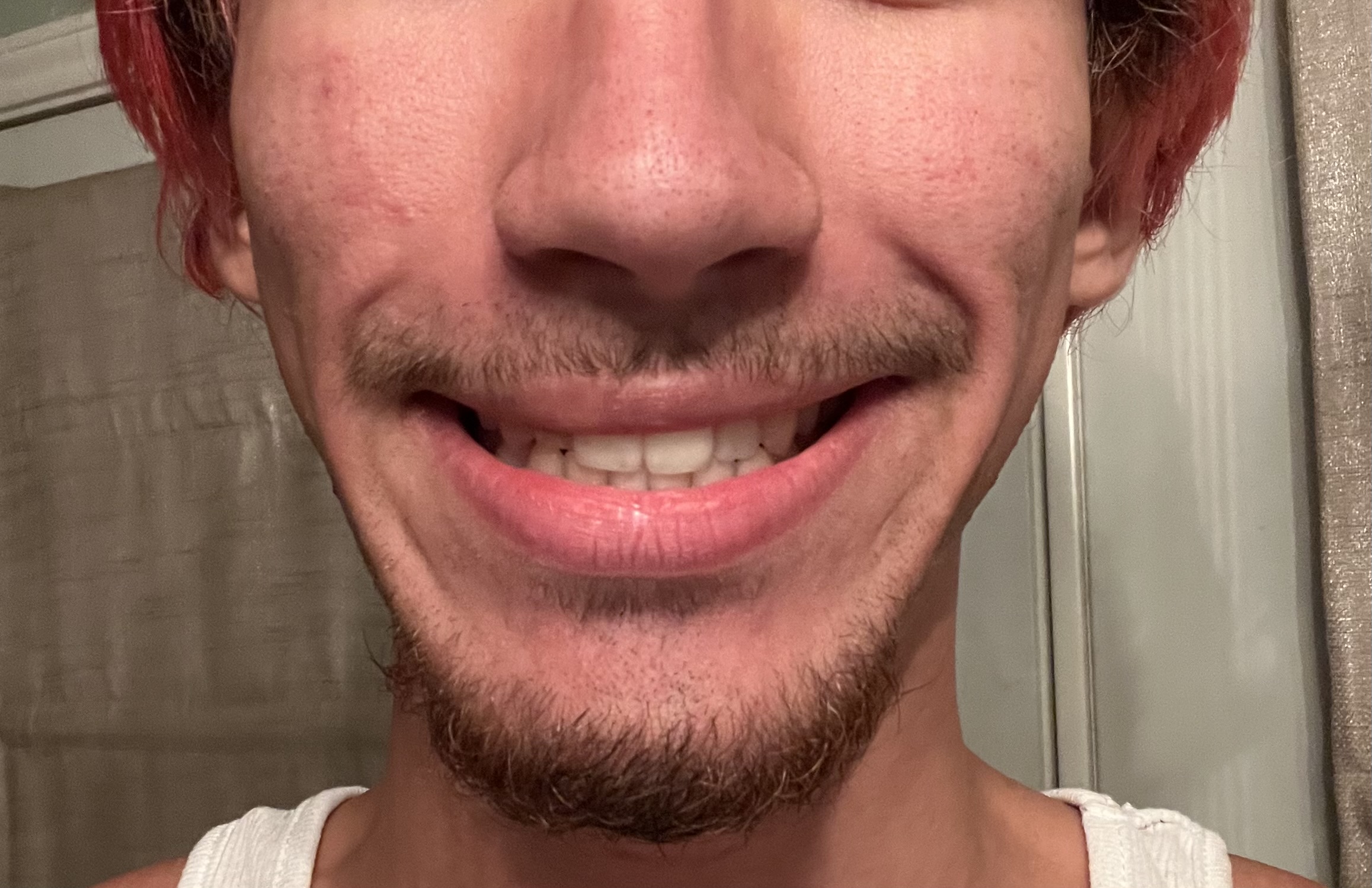 IMG 2610