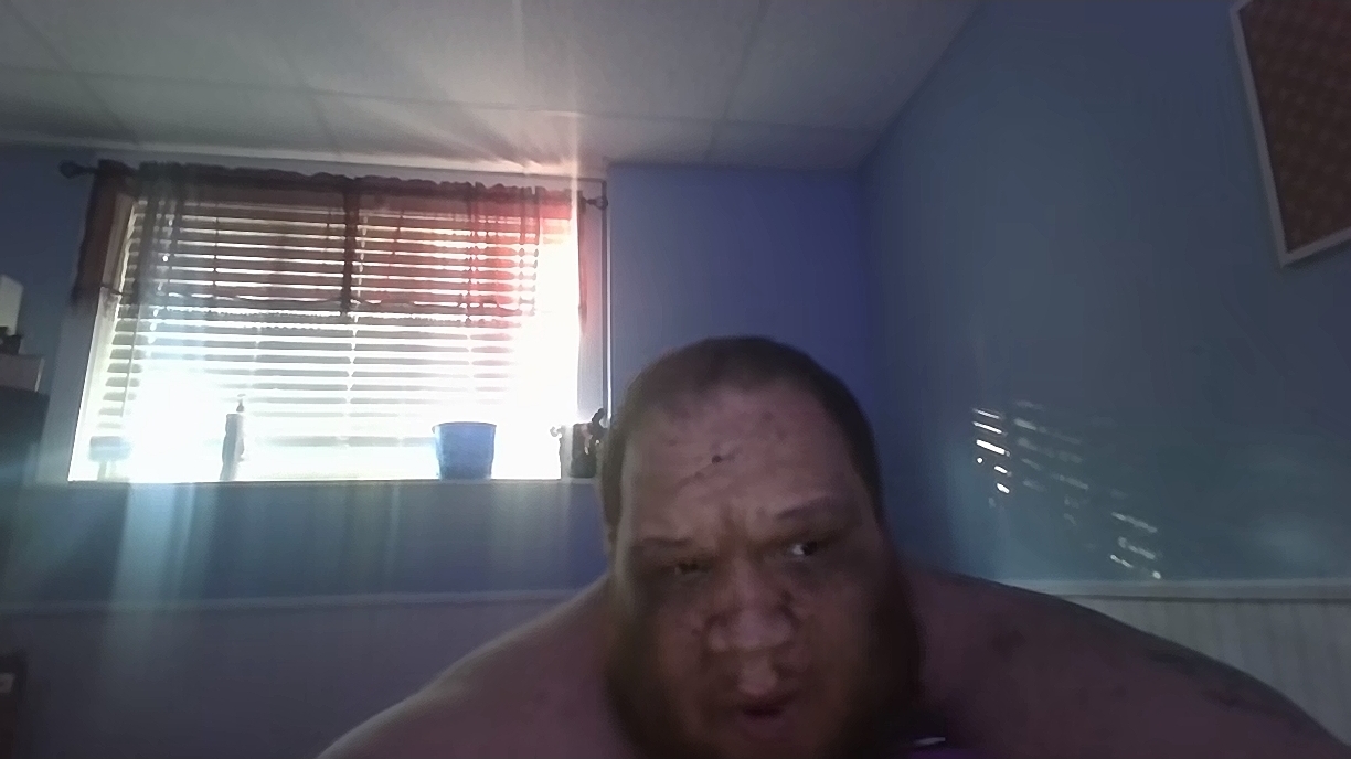 1000012725