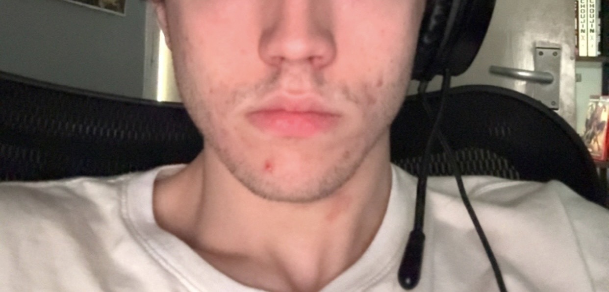 IMG 3659