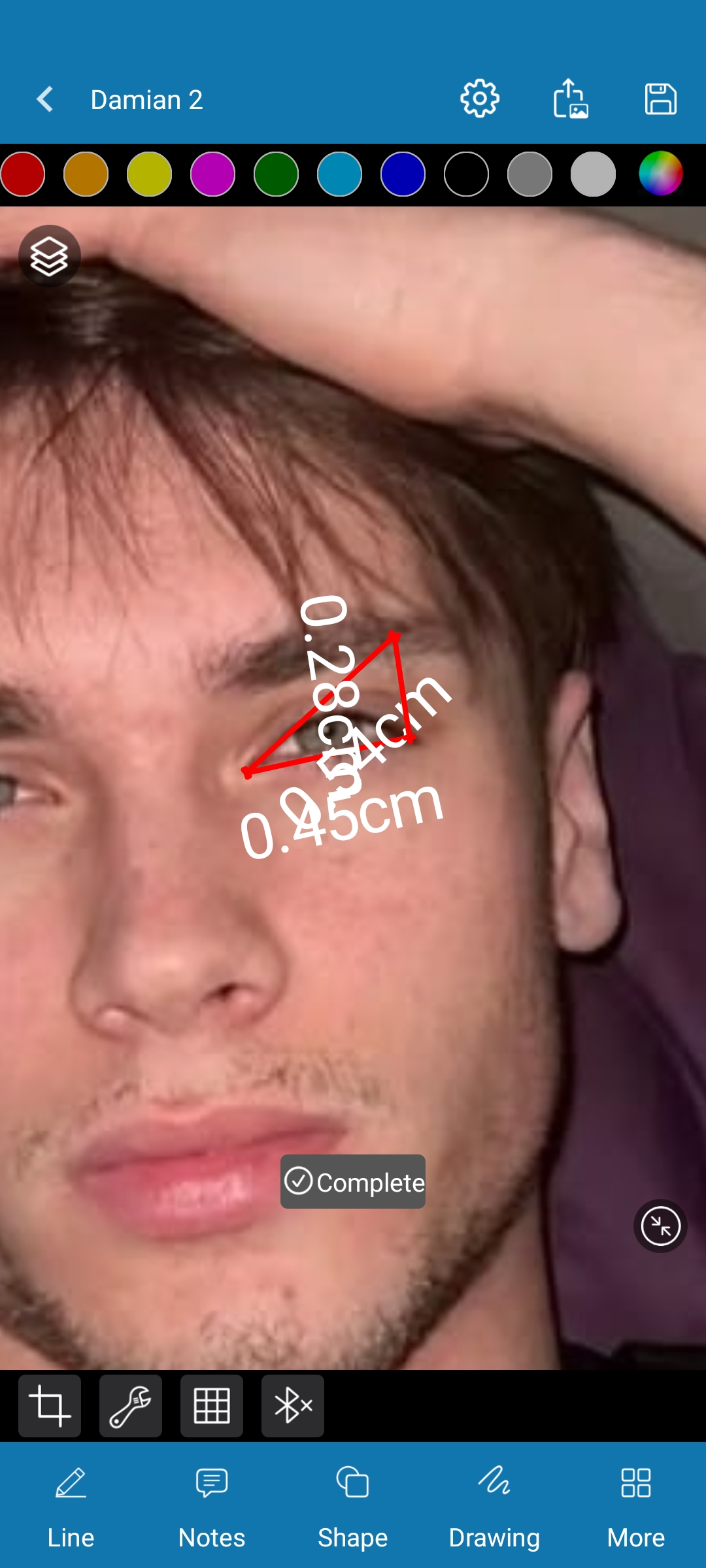 1000016925