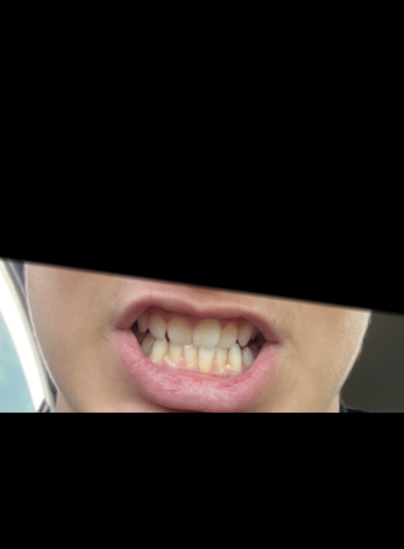 IMG 0009