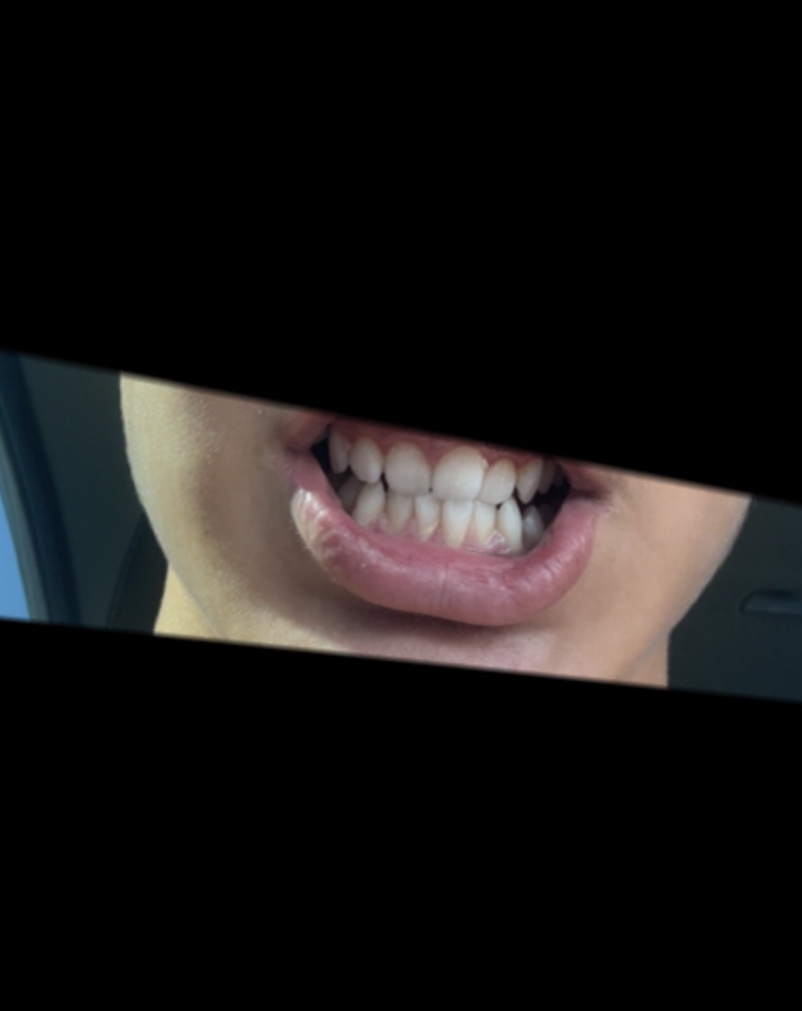 IMG 0010