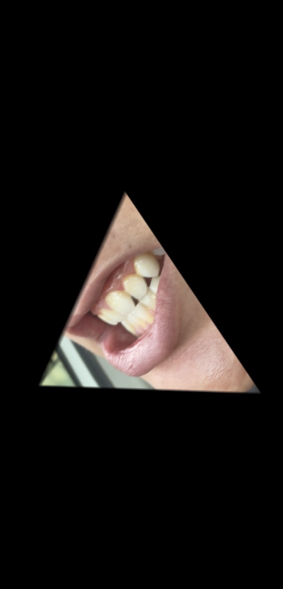 IMG 0011
