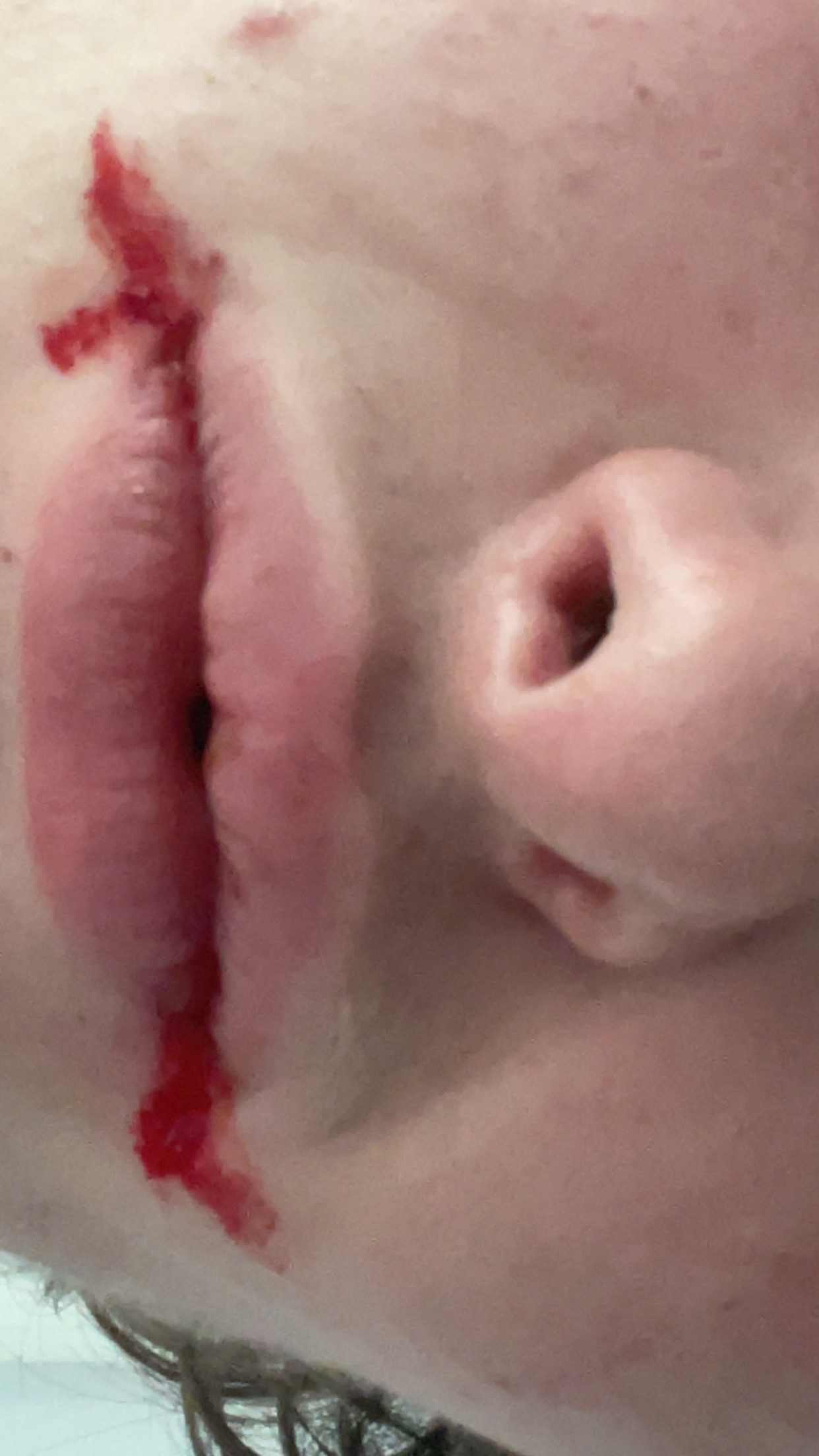 IMG 2236
