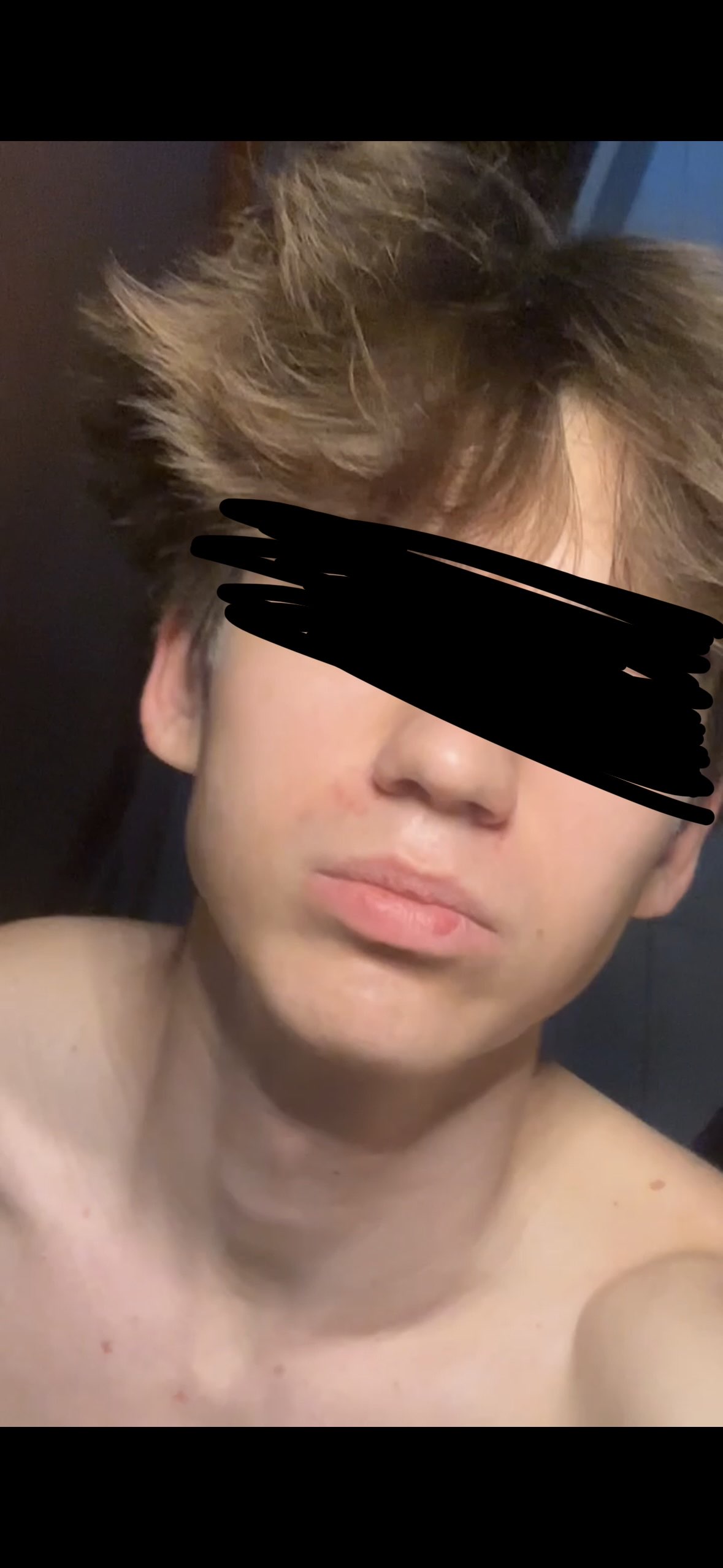 Swelling