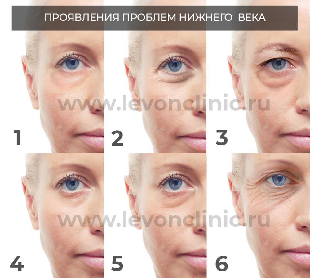 1785940429377