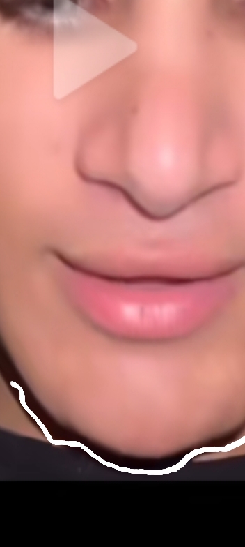 1000044159
