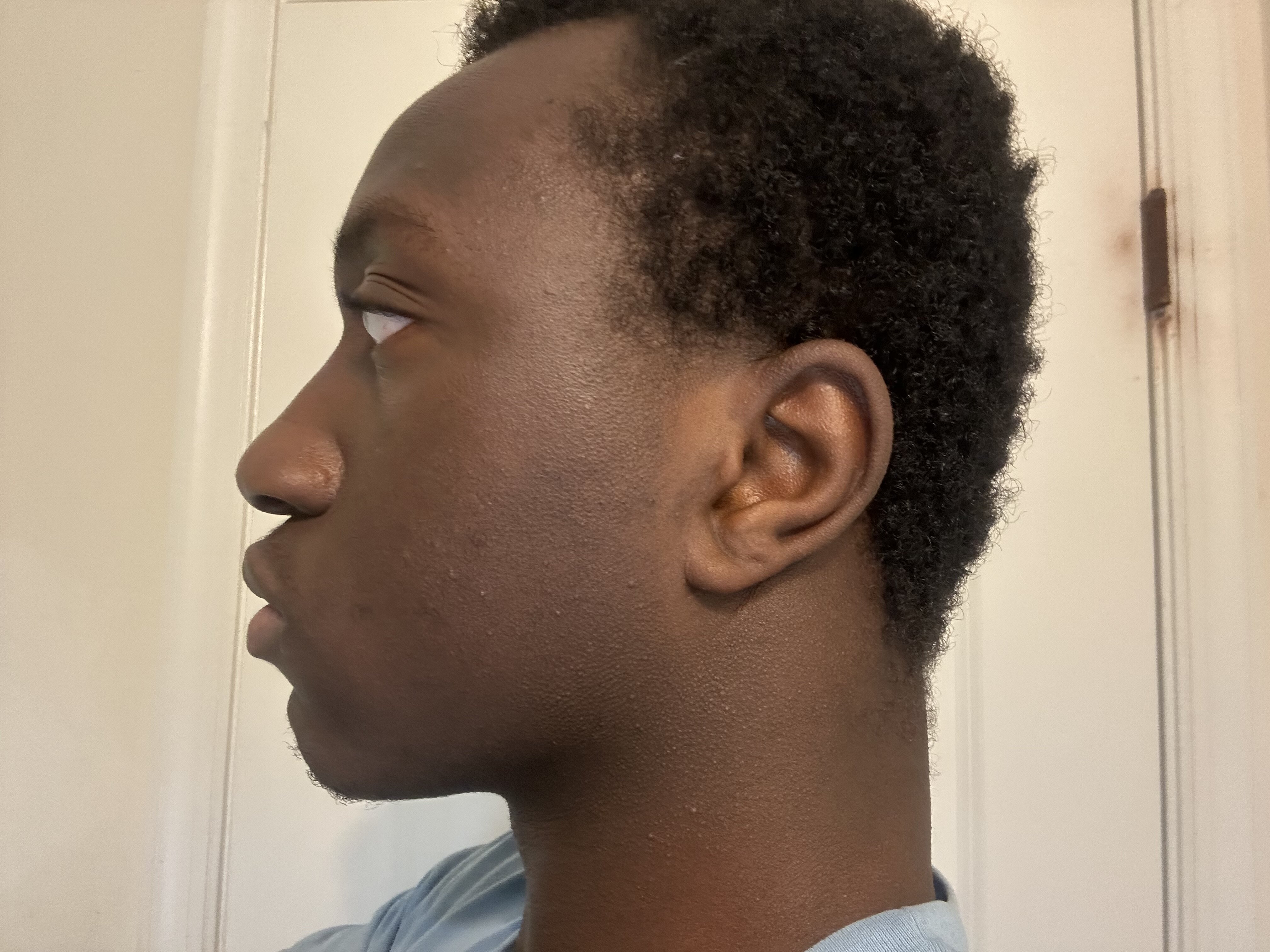IMG 2814