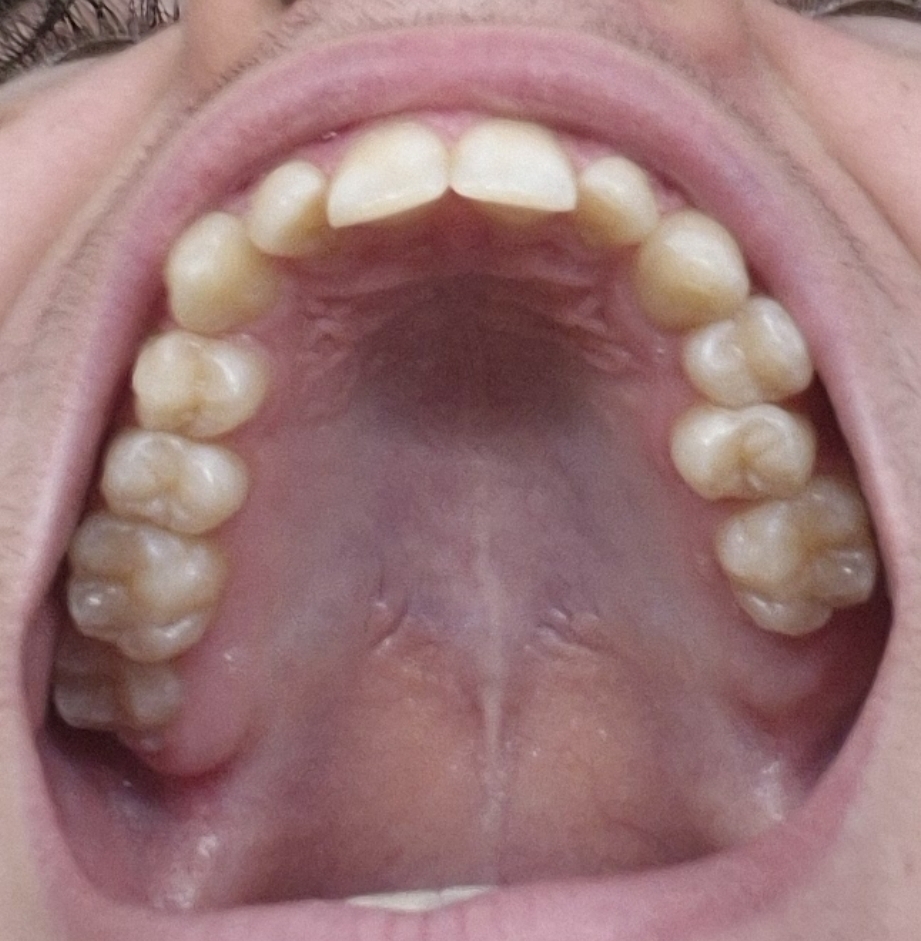 1000014555