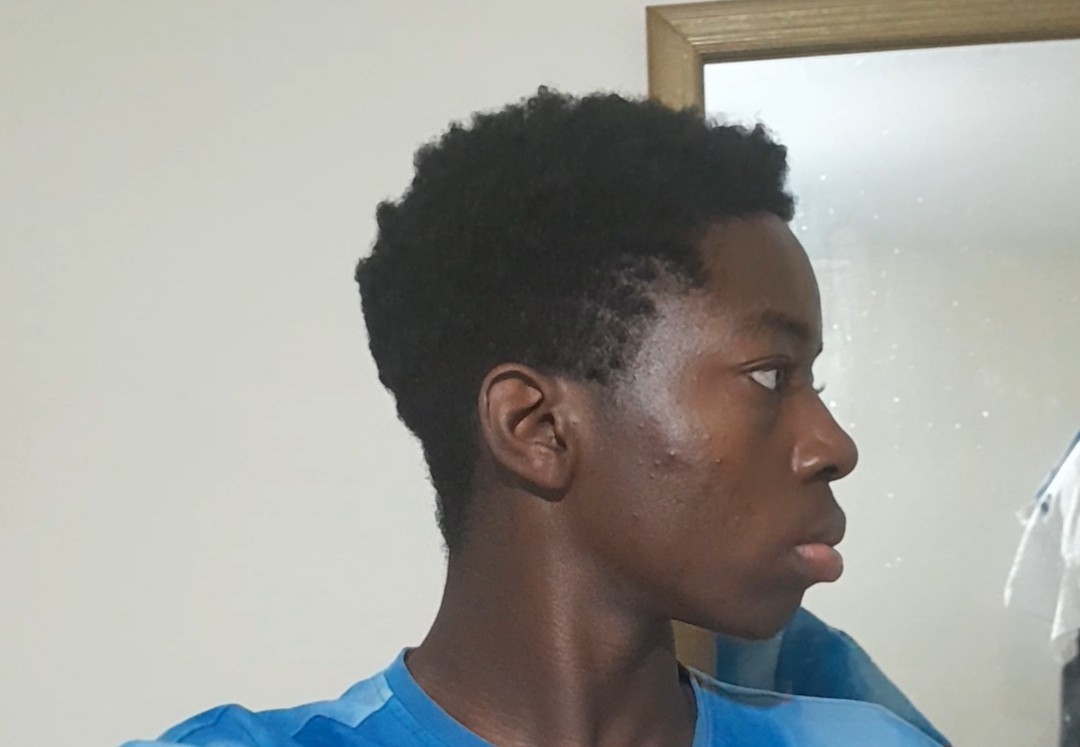 Side profile