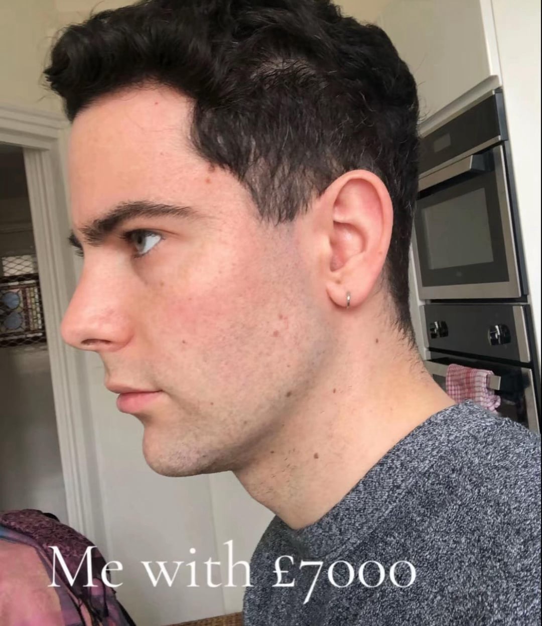 IMG 2620