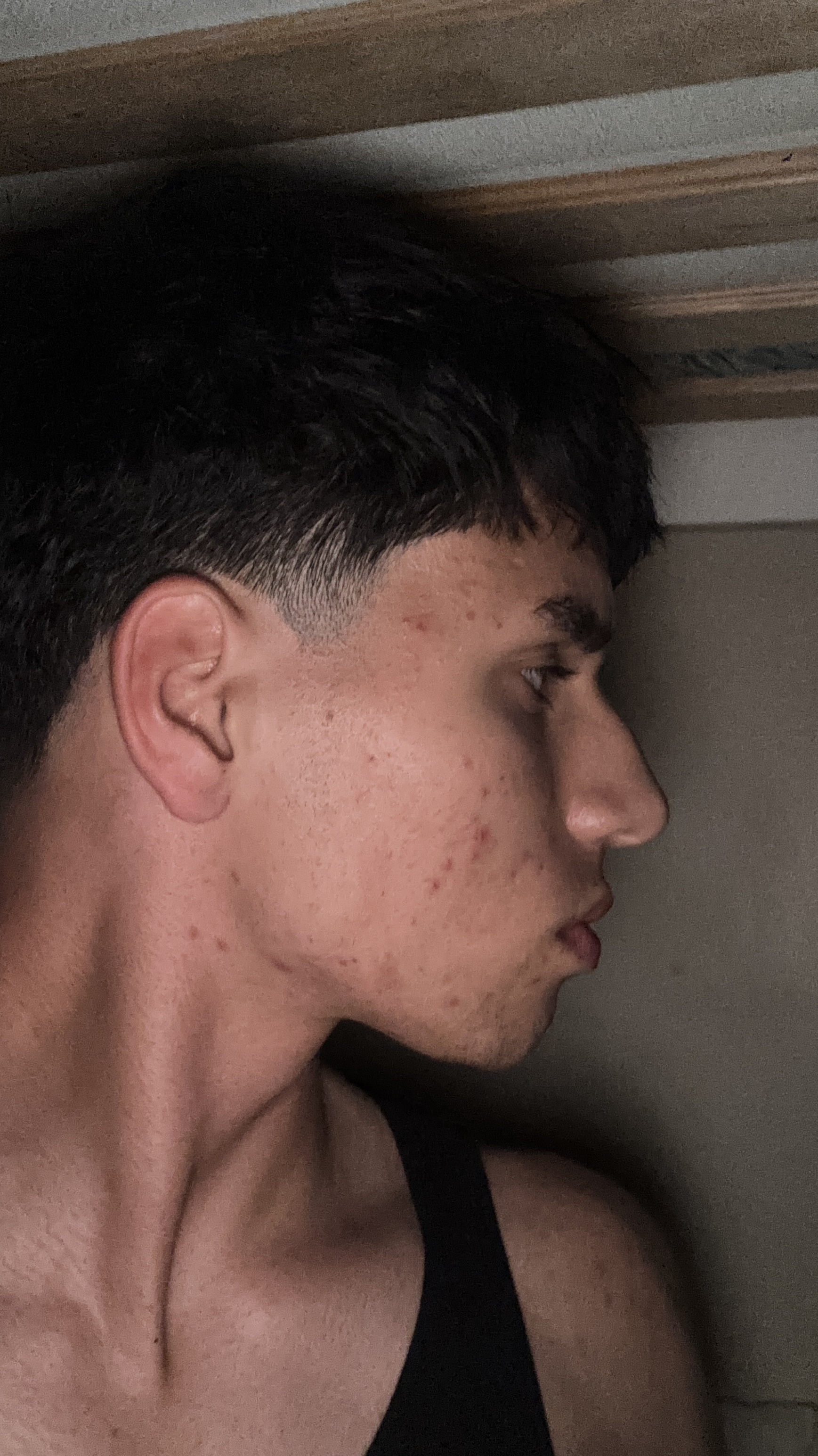 IMG 2408