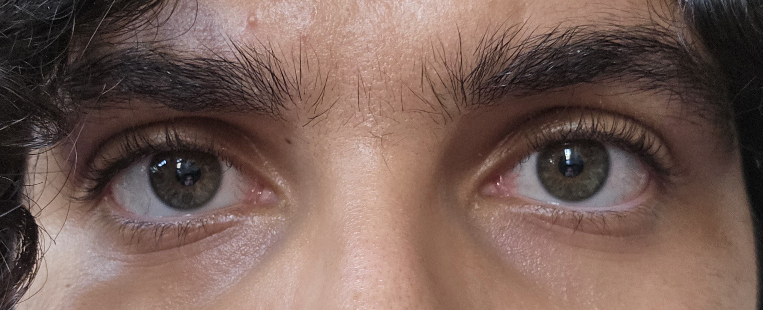 1000097017