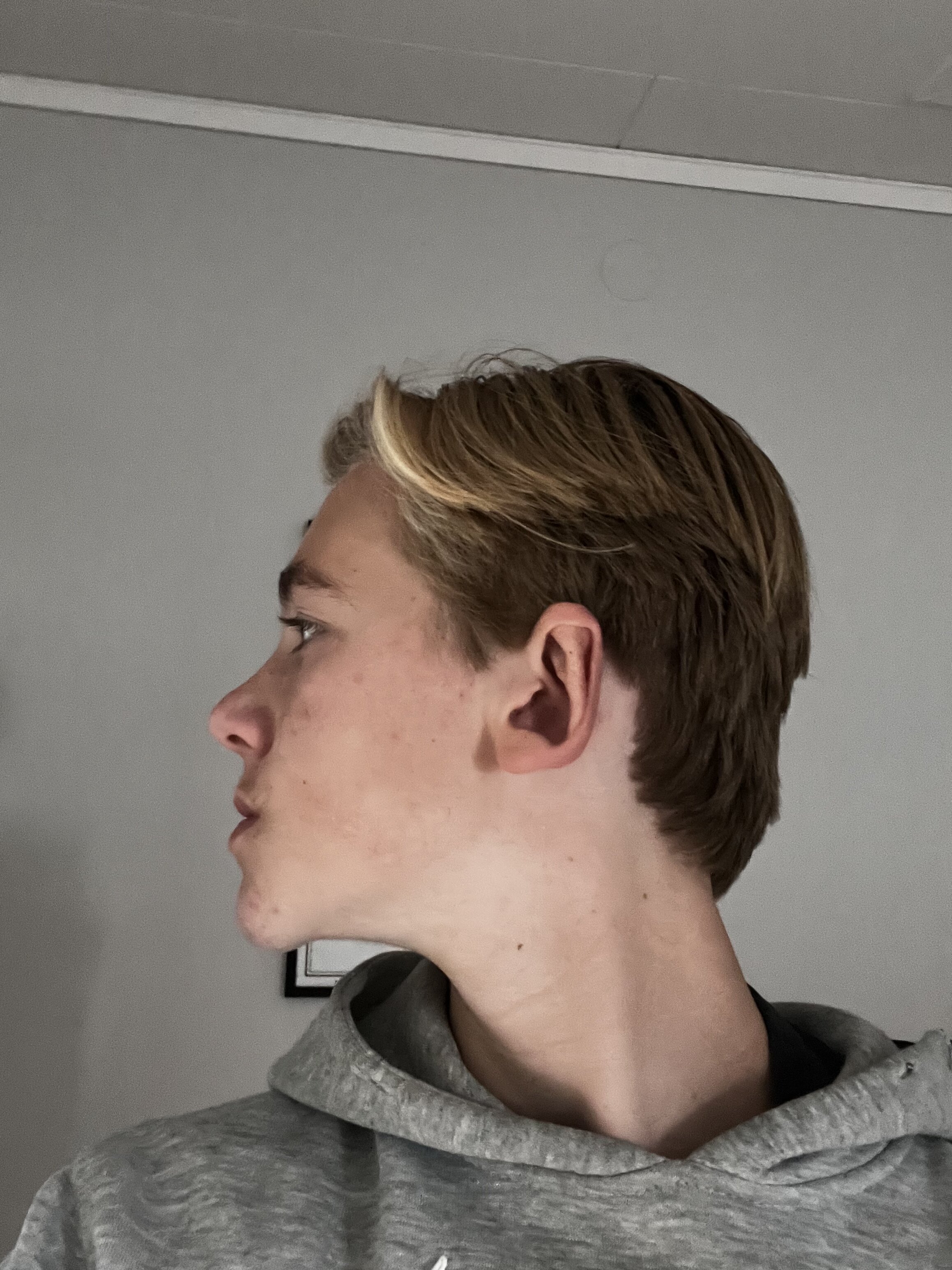 IMG 0876