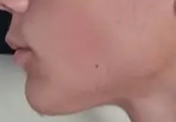 15221