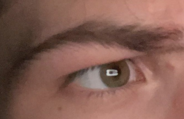 Brow1