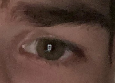 Brow2