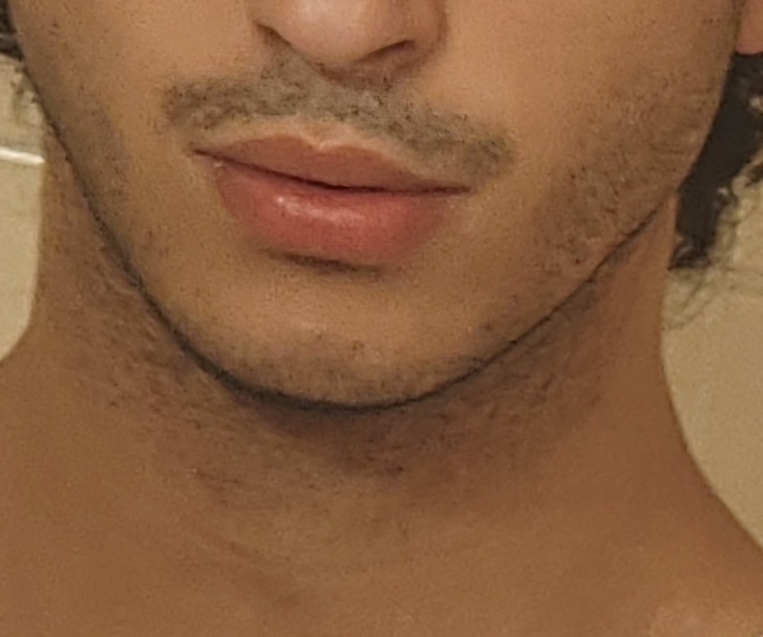 1000027379