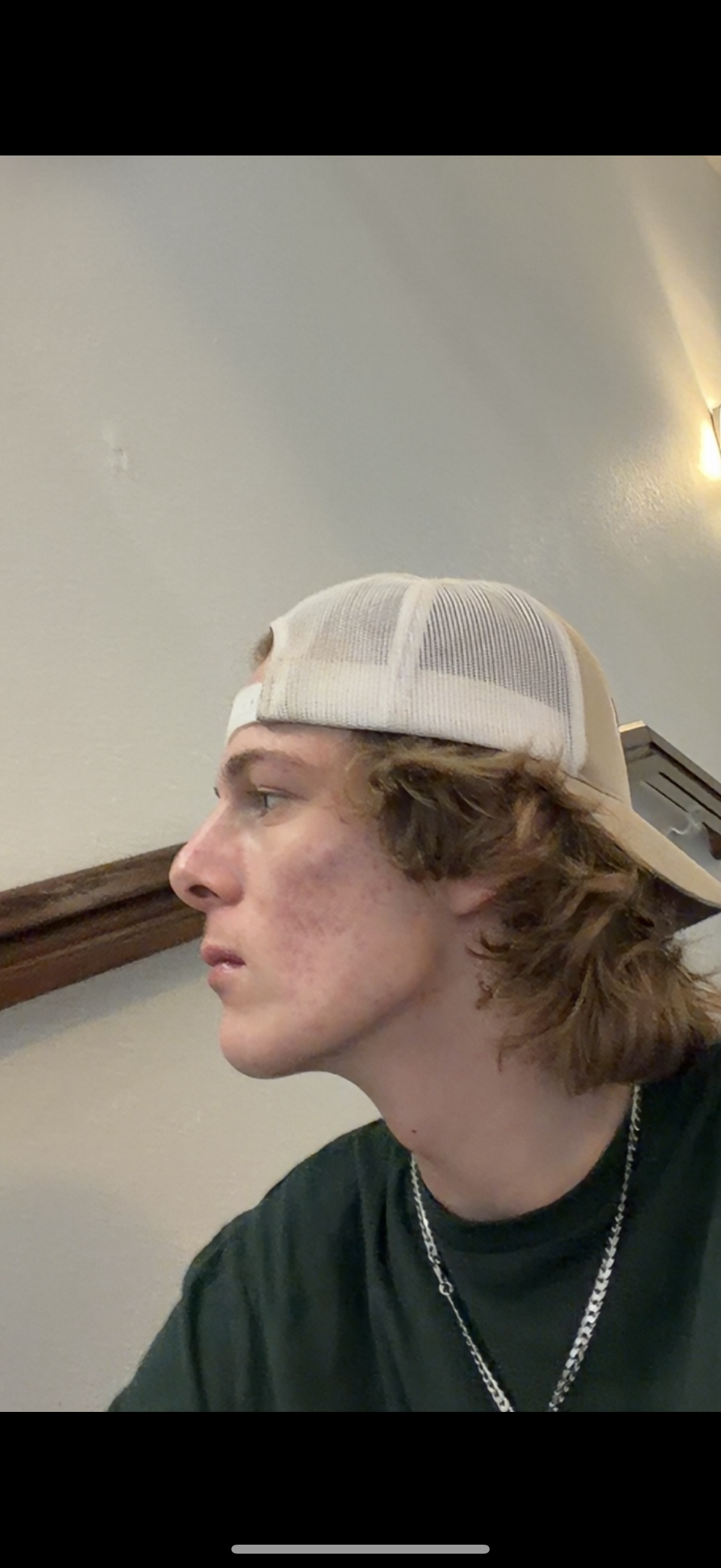 IMG 3076