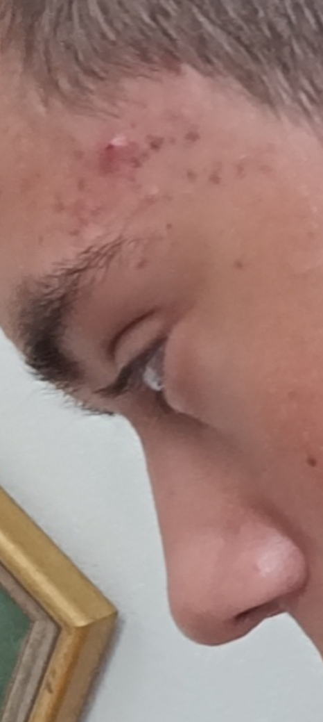 15312