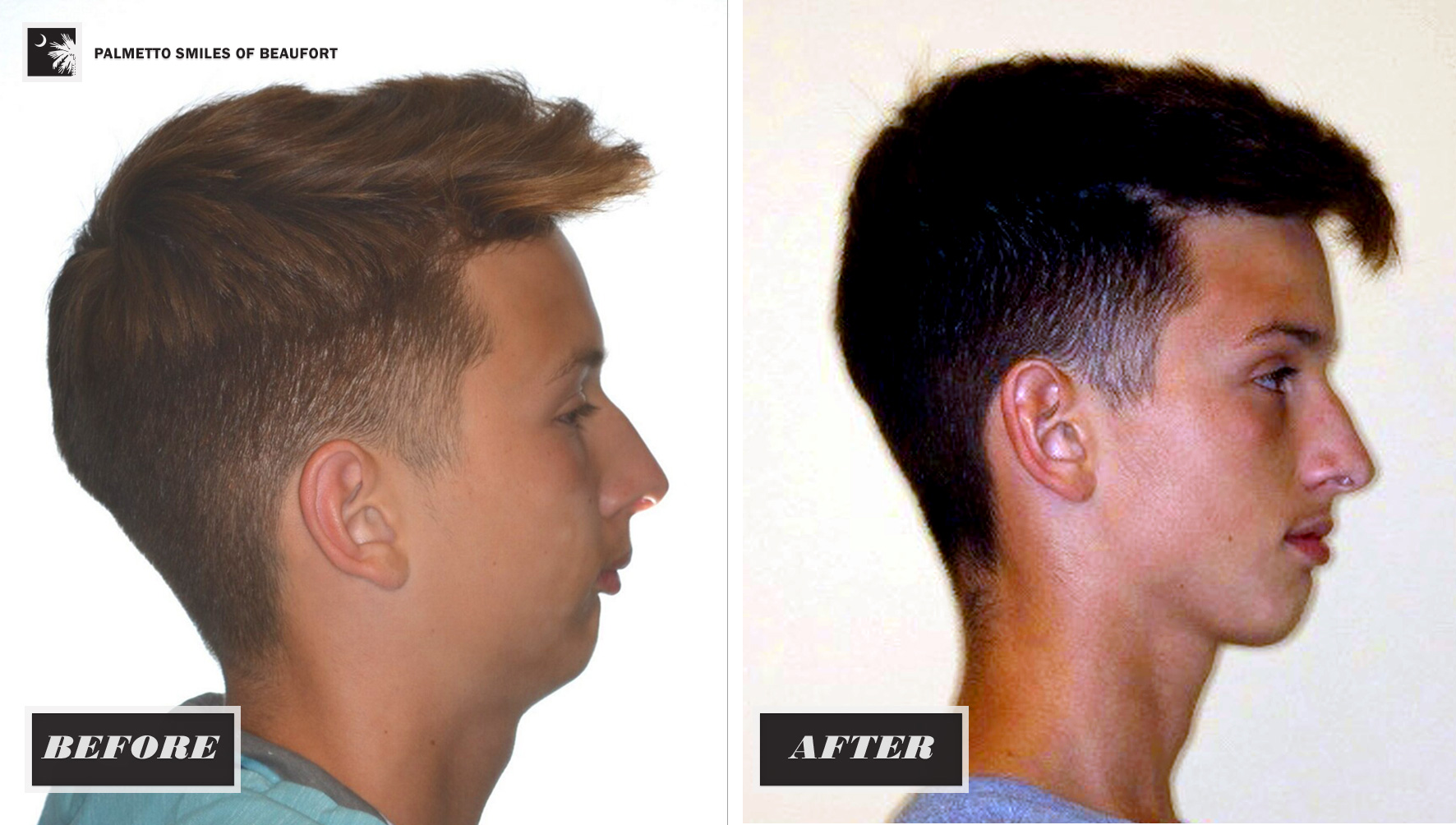 652948d5f6d45143ca554324 5ea099de59da28d30b29947a athan agga facial growth 2018