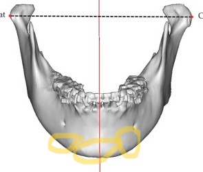 Oooo1804 fig 0003