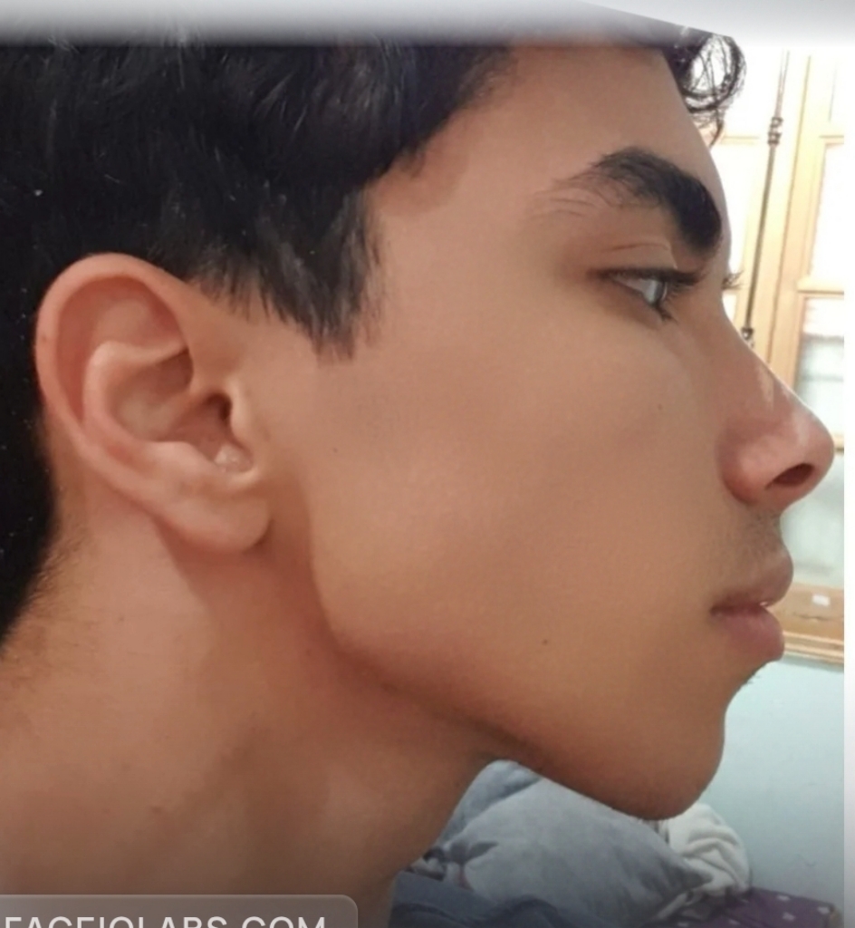 Retouch 2026081000163008