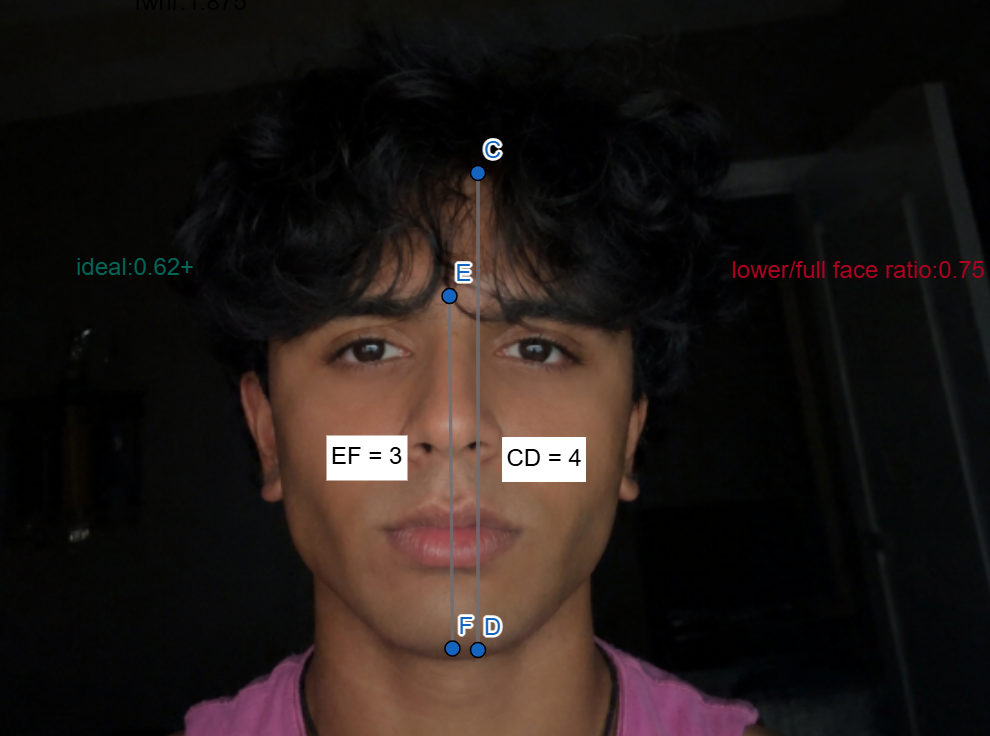Lower full face ratio