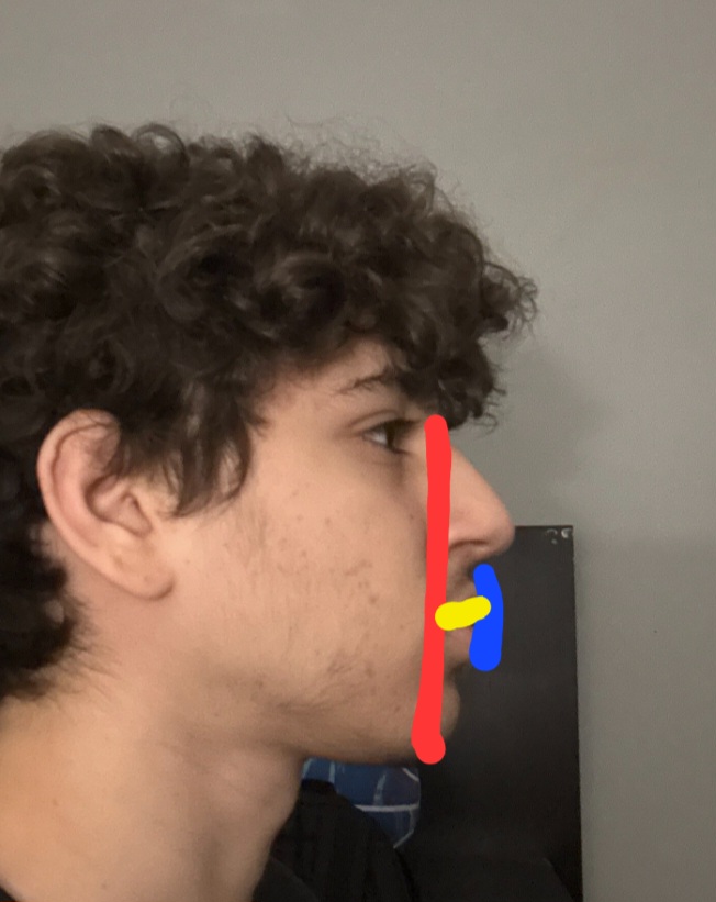 1000130984