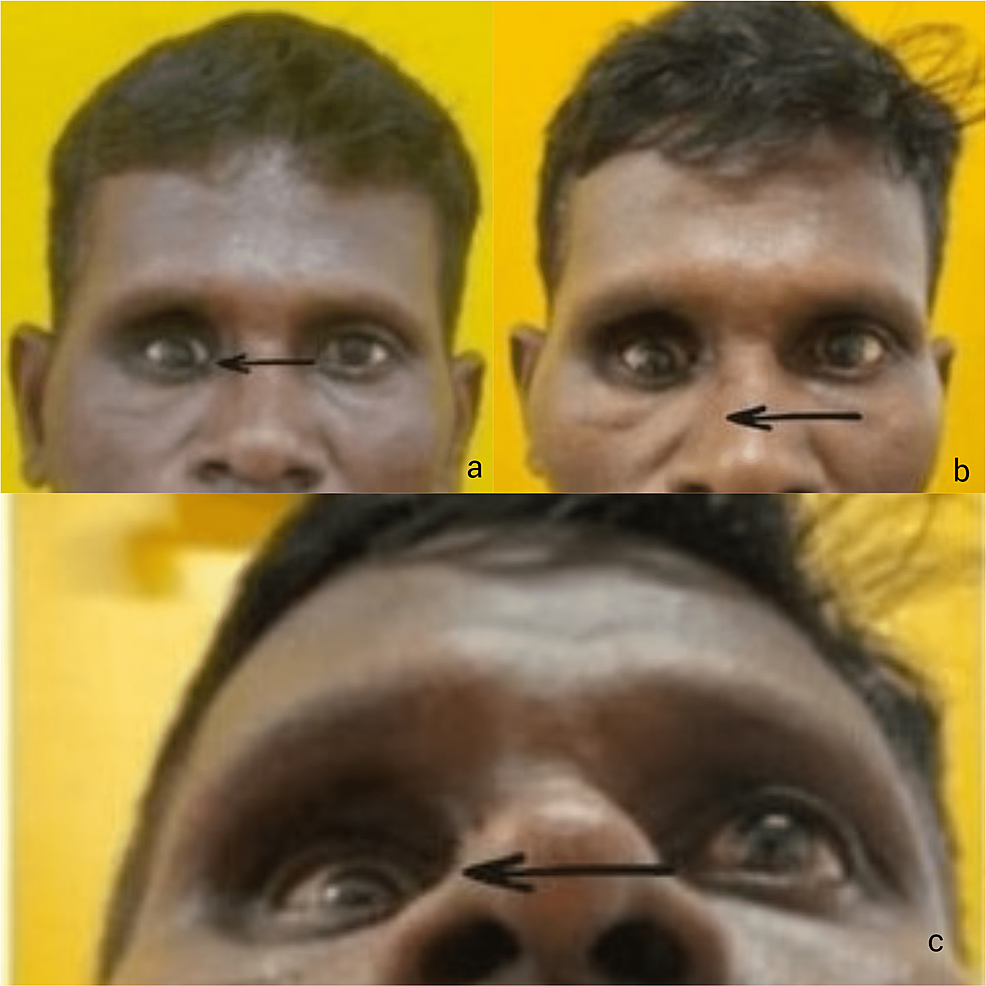 1000130986