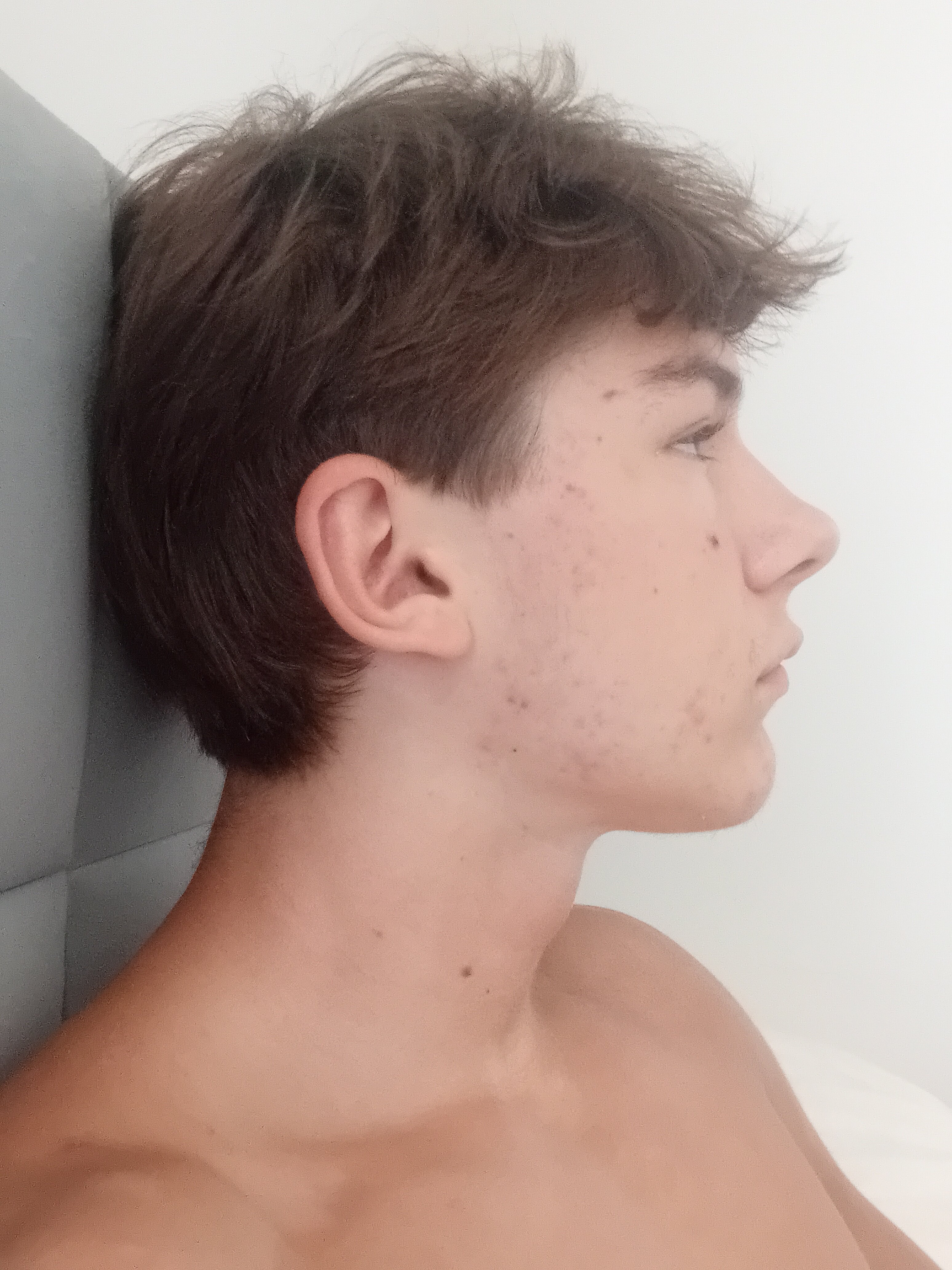1000030113