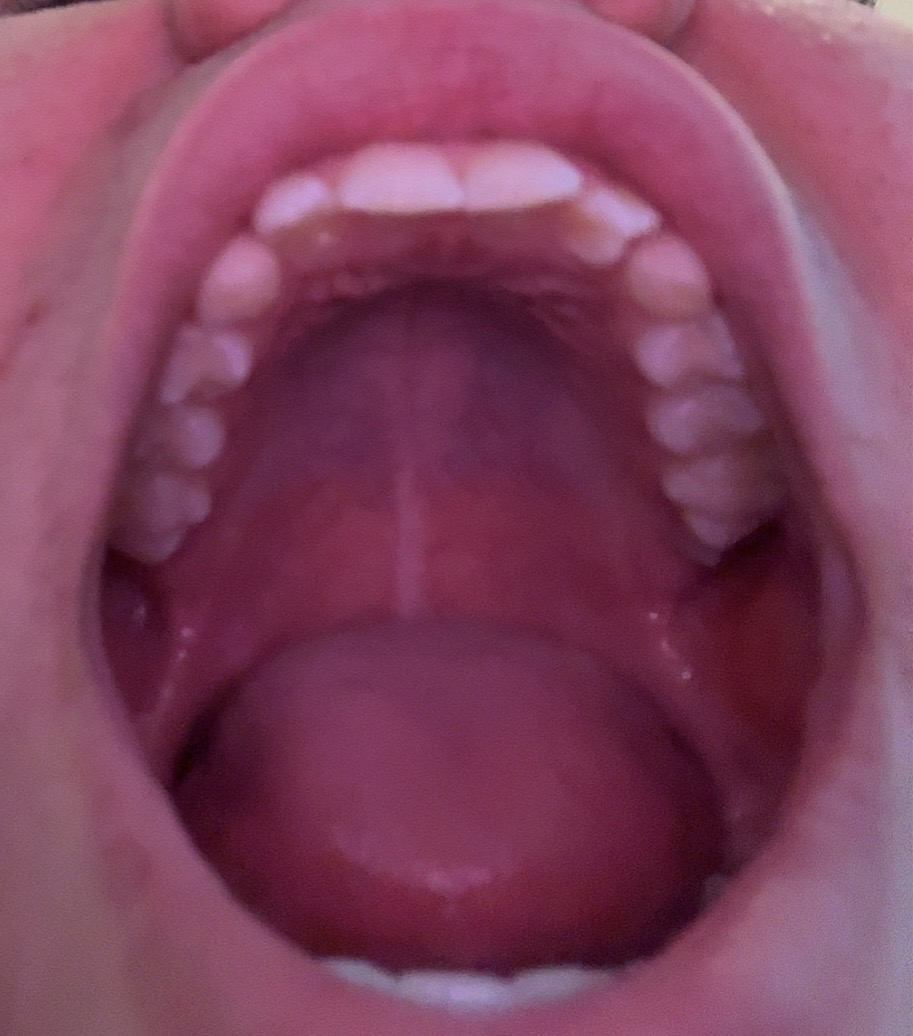 IMG 7644