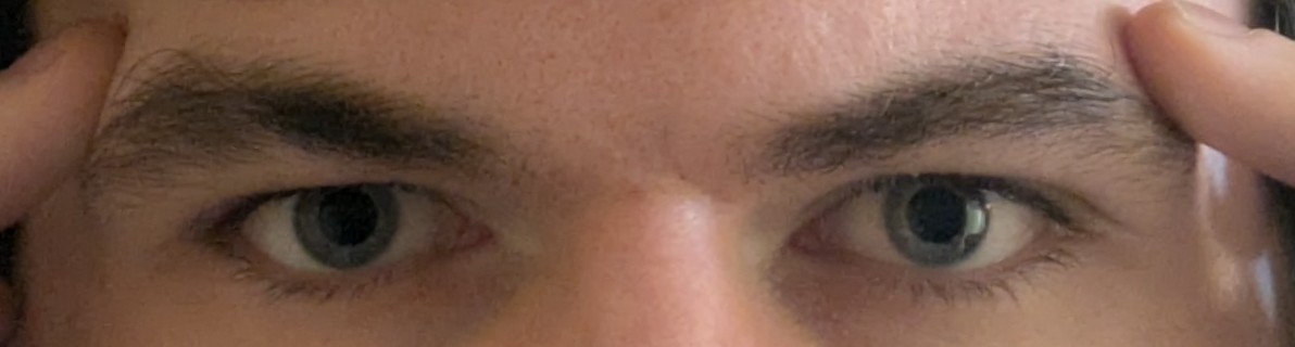 1000022293