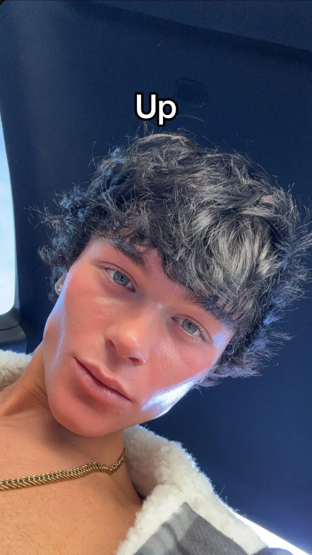 15581