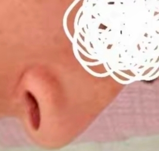 1000052561