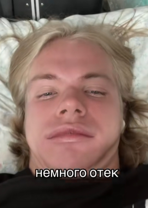1000035518