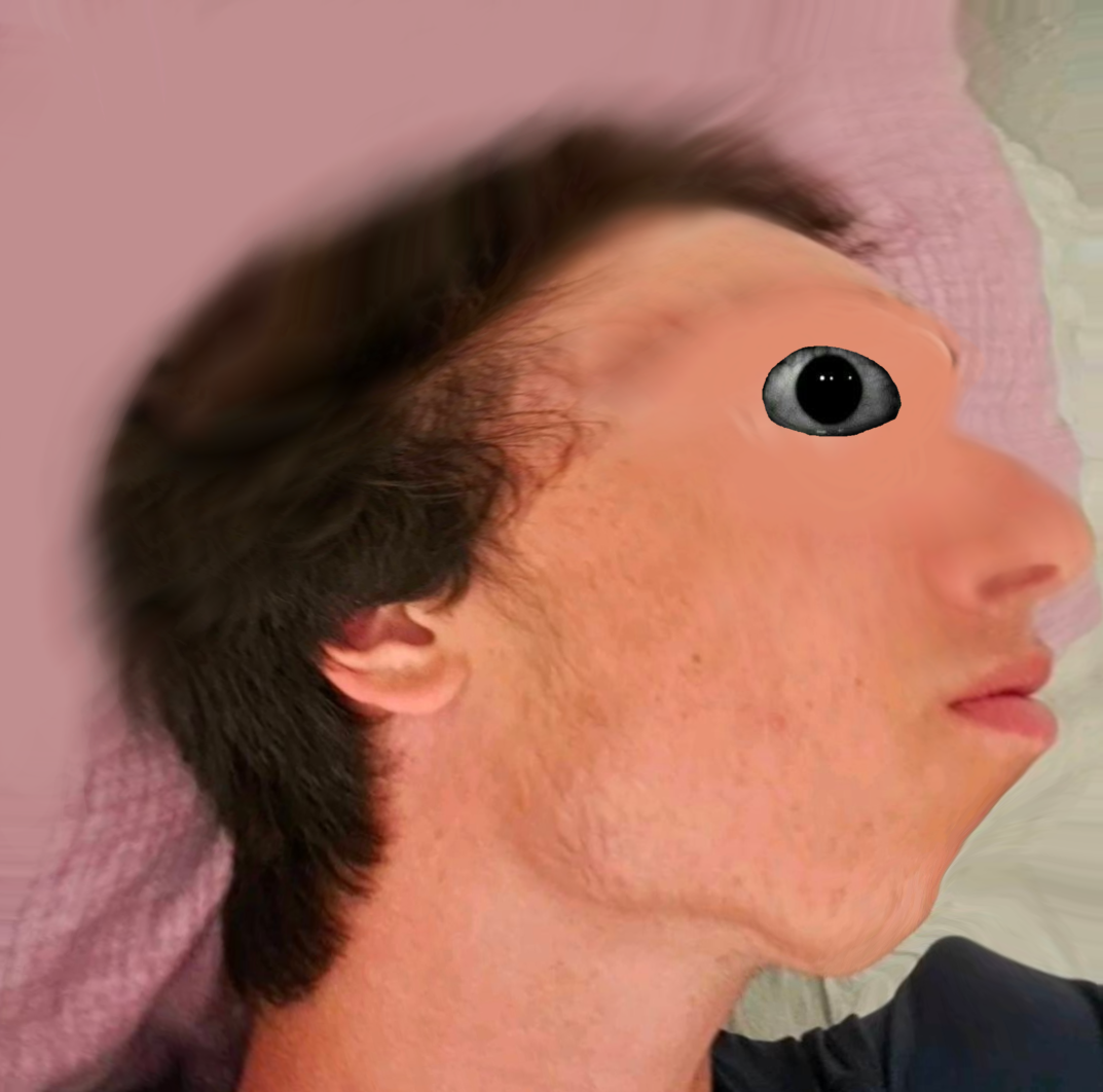 1000128452