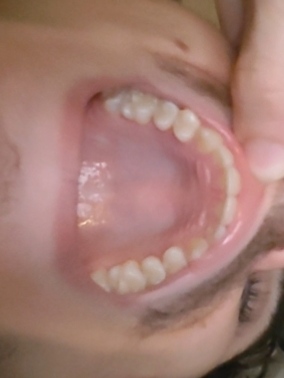 1000008104