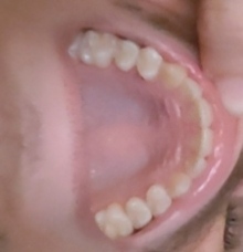 1000008105