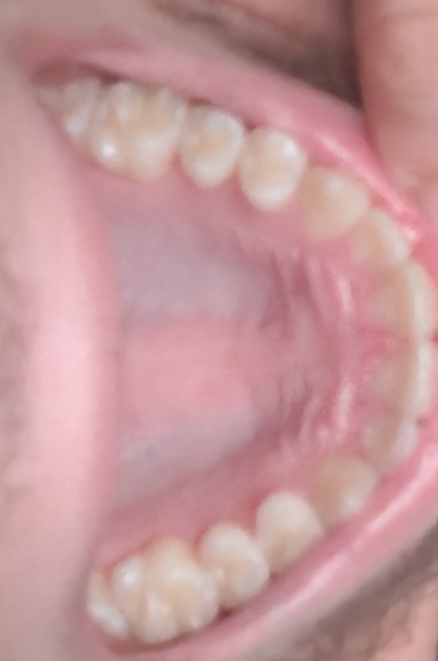 1000008112
