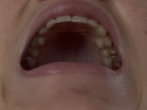 IMG 2012