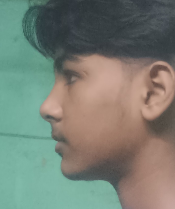 1000102641