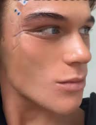 Eyetape
