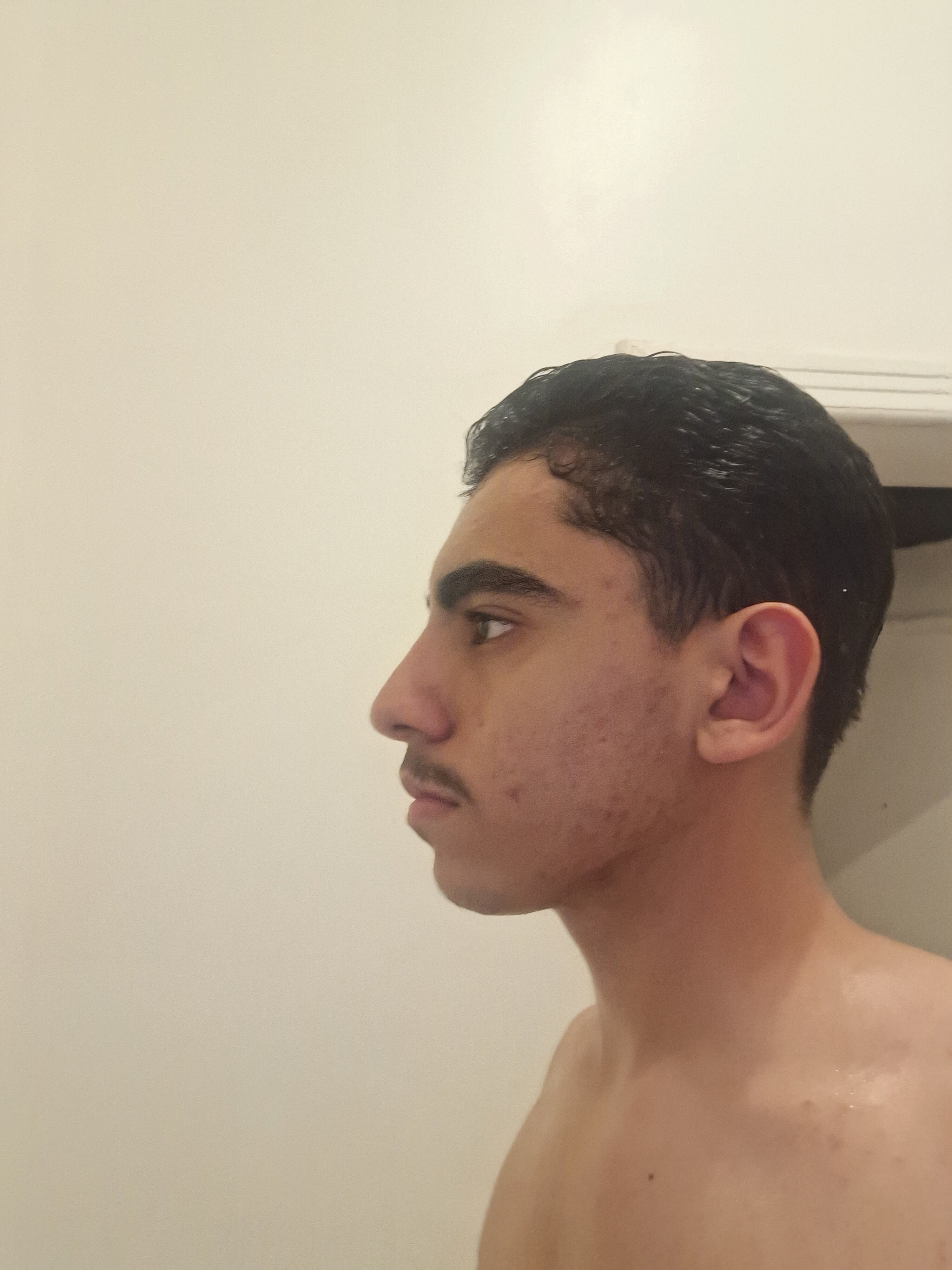 1000186375