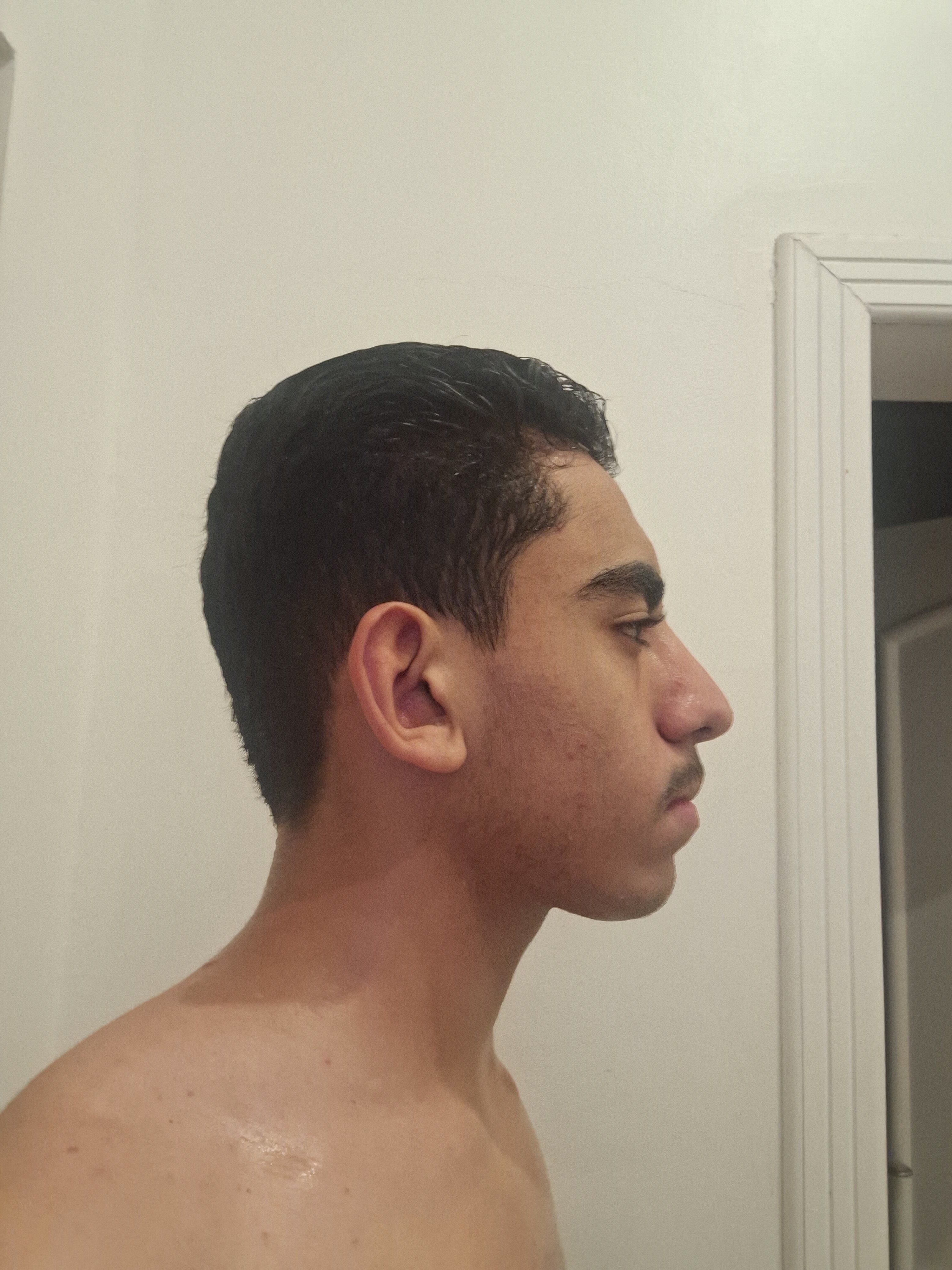1000186374