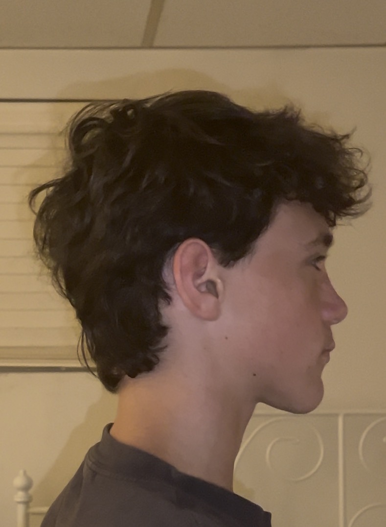 IMG 0978