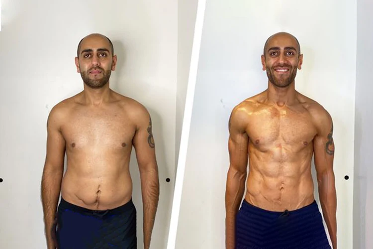 Challenges with Chest Genetics